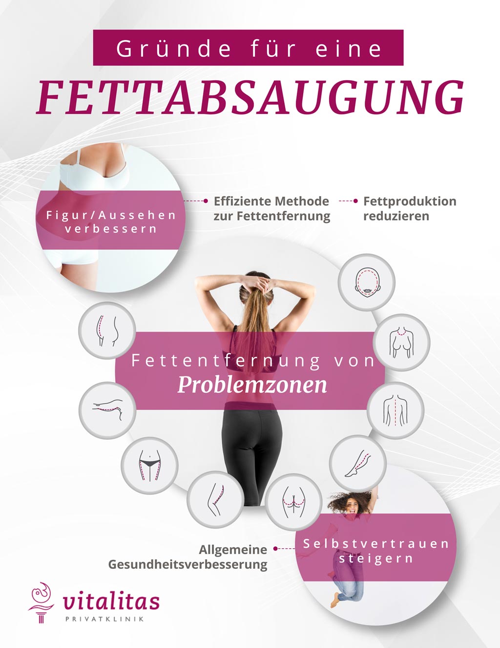 Infografik Gründe für eine Fettabsaugung