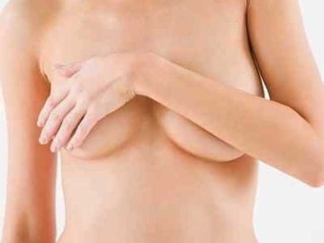 Breast reduction - limitations &amp; possibilities