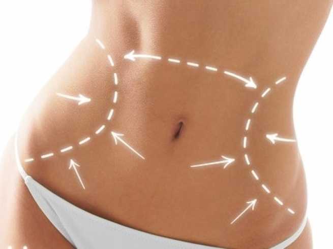 Abdominoplasty - possibilities &amp; risks