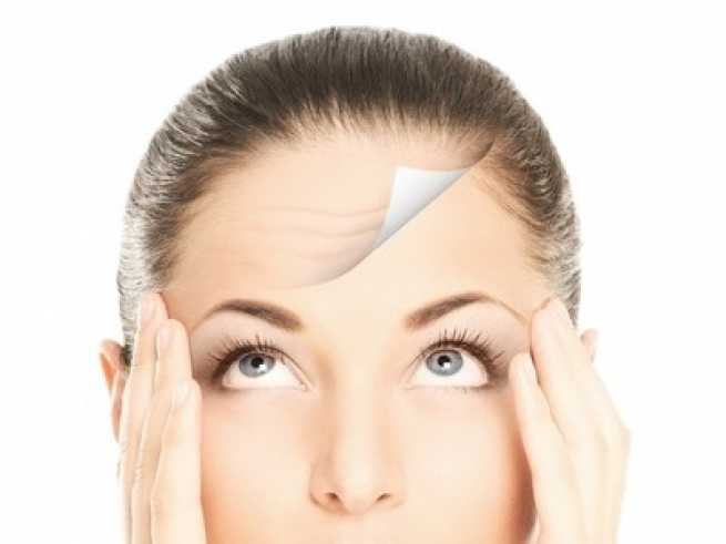 Forehead lift